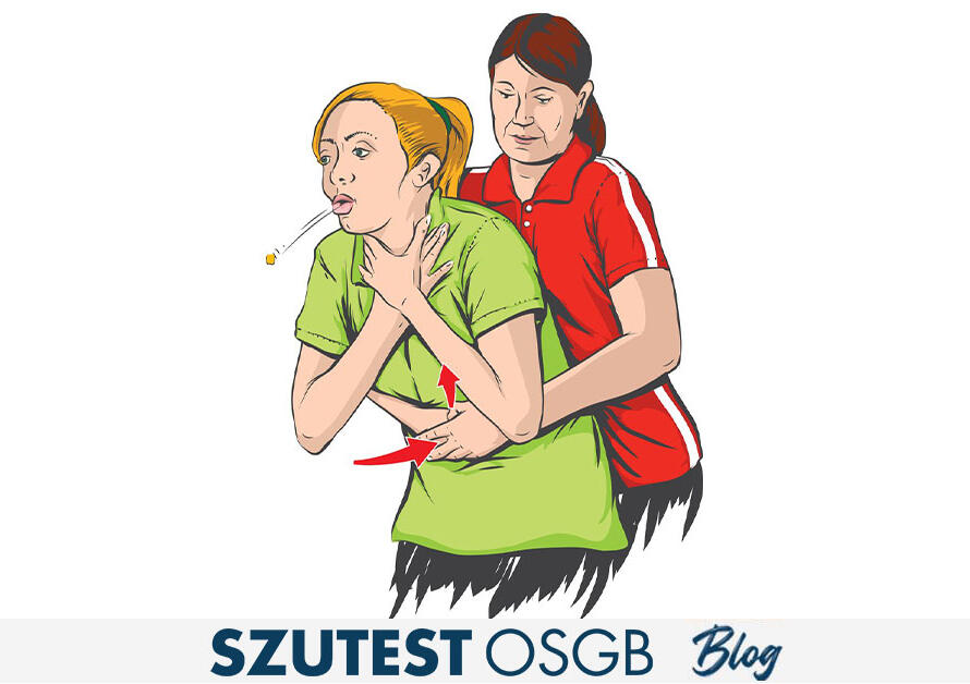 Heimlich Manevrası